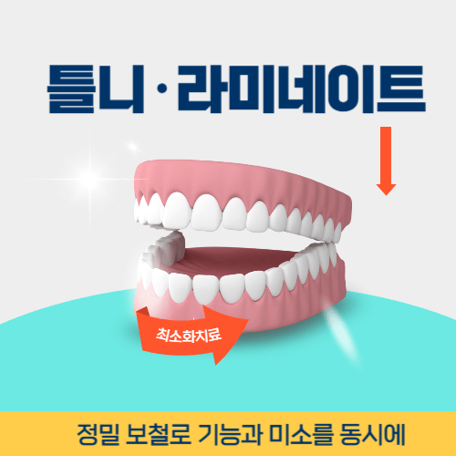 목포치과 목포시 치과 틀니 라미네이트