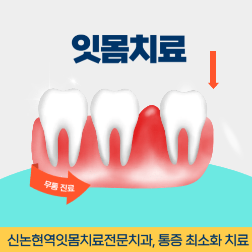 목포치과 목포시 치과 잇몸치료